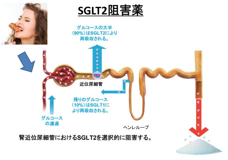 SGLT2阻害薬